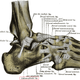 Illustration for article titled Pott’s Fracture or: Tim, Oh My God, I’m So Sorry About Your Leg